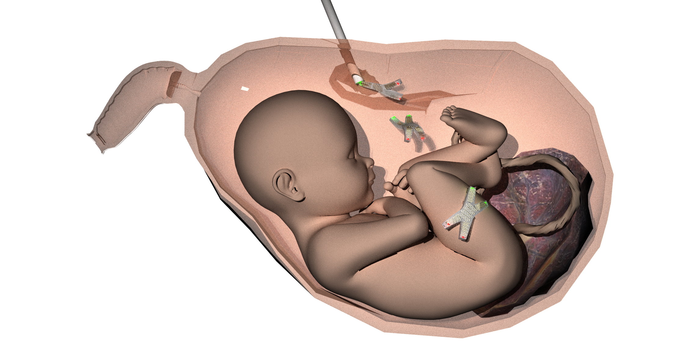 illustration showing the interaction of soft robotic bioelecronics and an unborn human child